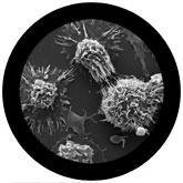Giant Microbes Cancer Cell (Turns Inside Out) Malignant Neoplasm - Guzzgoggs