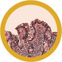 Giant Microbes Celiac Disease - Guzzgoggs