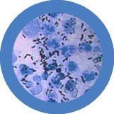 Giant Microbes Clap Gonorrhoea Keyring - Guzzgoggs