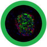 Giant Microbes Diabetes Beta Cell Insulin Β Cells - Guzzgoggs
