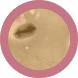 Giant Microbes E. Coli Escherichia Coli - Guzzgoggs