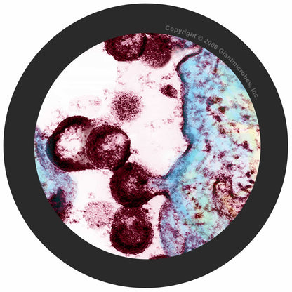 Giant Microbes HIV Human Immunodeficiency Virus - Guzzgoggs