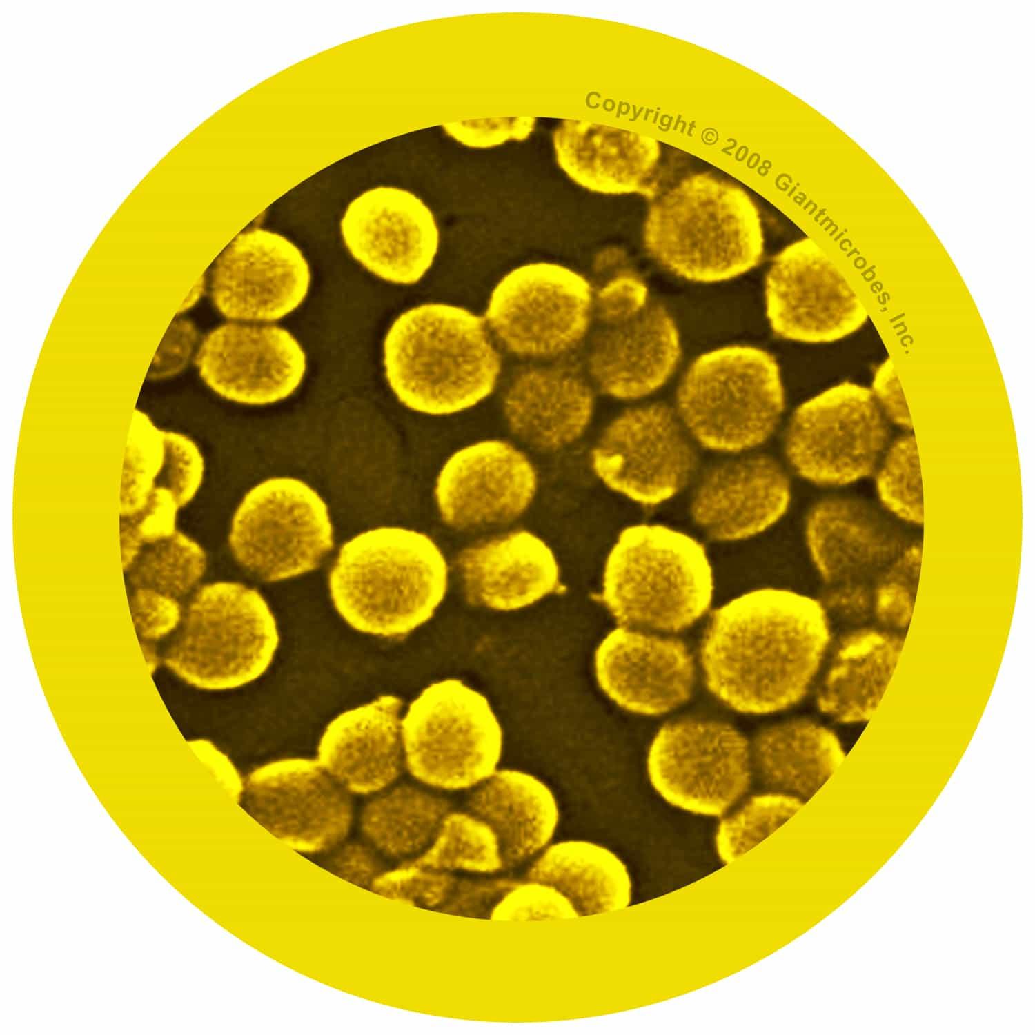 Giant Microbes MRSA Methicillin - Resistant Staphylococcus Aureus - Guzzgoggs