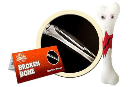 Giant Microbes Original Broken Bone - Guzzgoggs