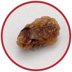 Giant Microbes Original Kidney Stone - Guzzgoggs