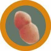 Giant Microbes Original Pneumonia - Guzzgoggs