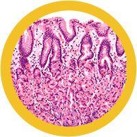 Giant Microbes Original Stomach Cell - Guzzgoggs
